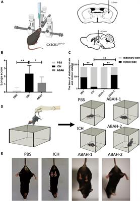 Effects and mechanism of myeloperoxidase on microglia in the early stage of intracerebral hemorrhage